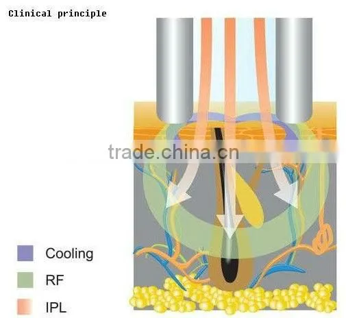 Fractional photoepilation! ipl+rf elight machine for hair removal C006
