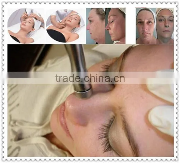 High quality diamond microdermabrasion tips AF-FT