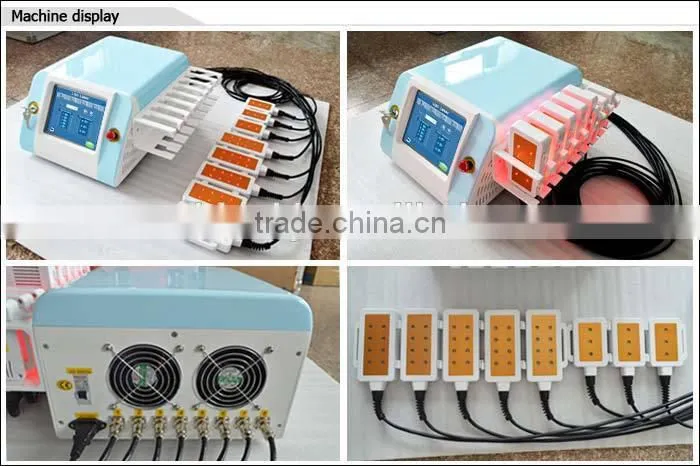 laser weight lose machine/body shaping machine/fat remover