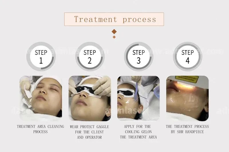 Best Price Nd Yag Pico Laser Tattoo Removal Machine With Super Hair Removal System Ipl Laser Hair Removal Machine for Sale