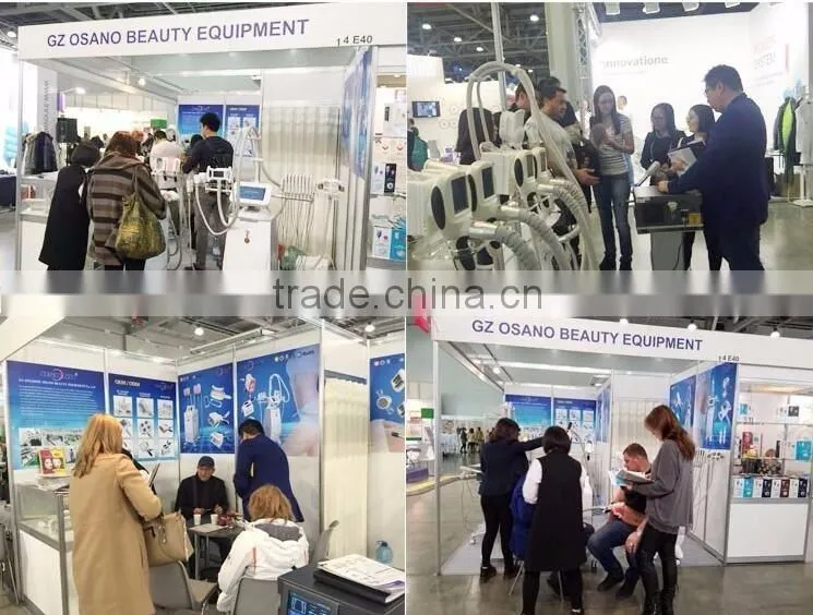 low price vacuum roller weight loss slimming machine