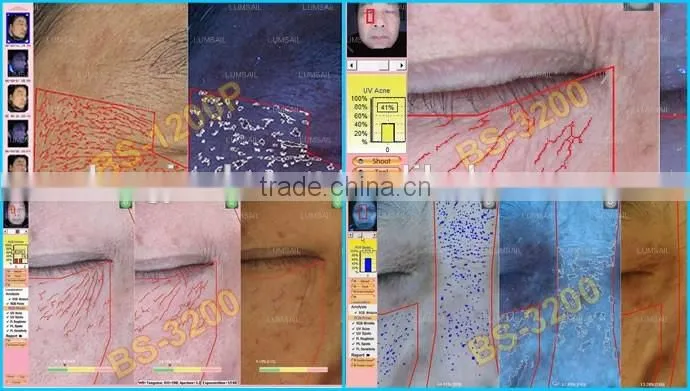 portable face analysis machine BS-3200 bia skin analyzer machine