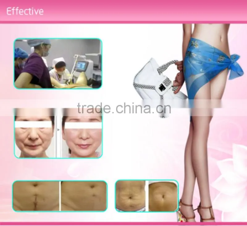 Best promotion price/fractional co2 laser/co2 fractional laser/laser equipment co2 fractional for vaginal tightening