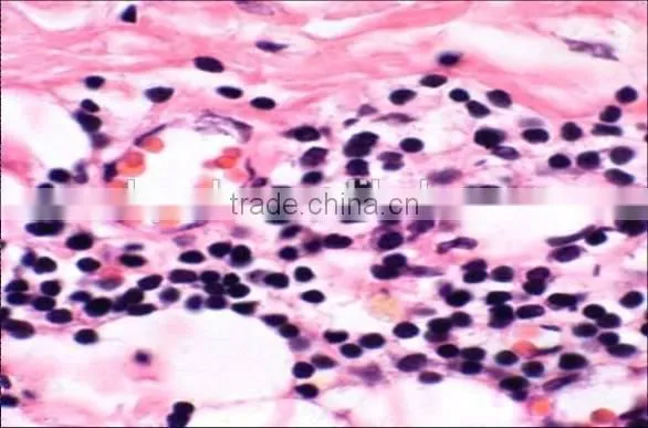 Superfine Medical Prepared Microscope Slides of Moving-point Muscle