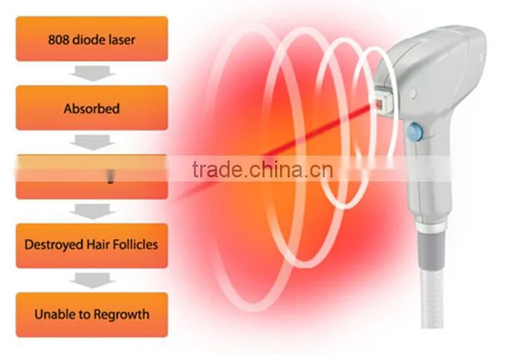 Professional lightsheer diode laser hair removal 808 nm laser diode portable