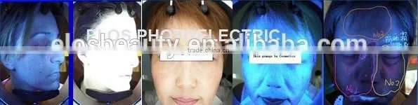Professional Facial Skin Scanner Analyzer