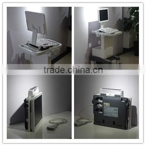 DICOM3.0 modern laptop medical diagnostic equipment