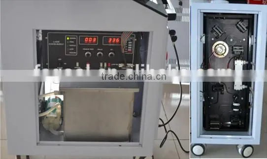 q-switch nd yag laser korea for tattoo removal