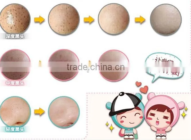 The 2015 newest Nose blackhead removal mask