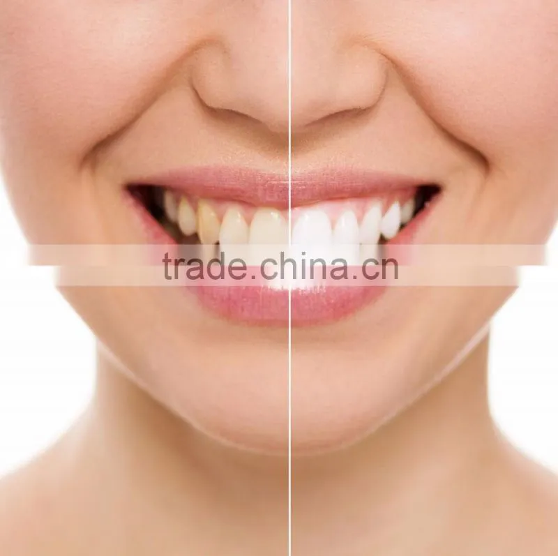 3ml Teeth Whitening Gel Syringe | Choose your Gel: HP, CP + OEM