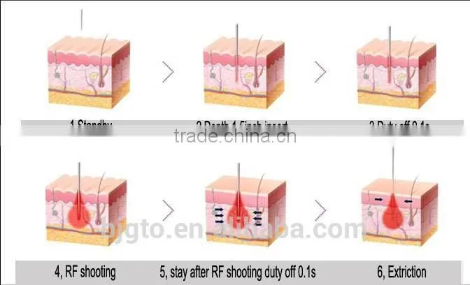 2014New Professional micro needle RF fractional machine skin rejuvenation,wrinkle removal,skin tighten