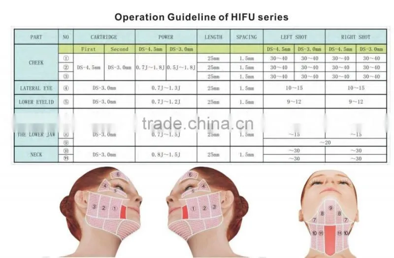 ultra age hifu