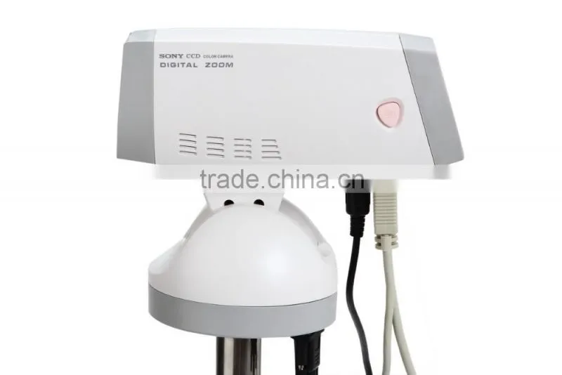 FY-9100A Excellent Portable Type Digital Electronic Colposcope