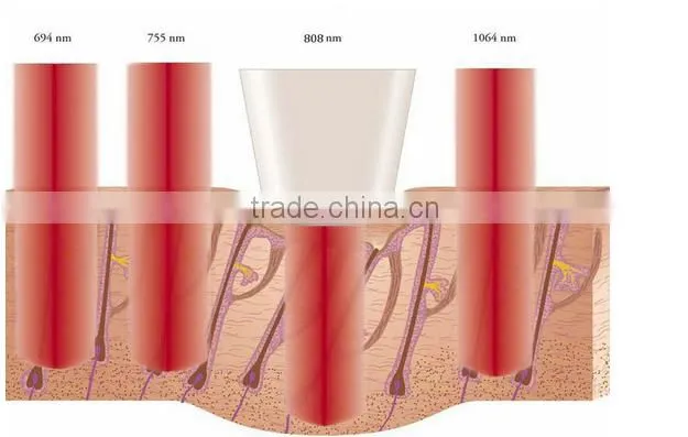 12 Bars 808nm Diode Laser Hair Removal Machine Cosmetic Laser Equipment