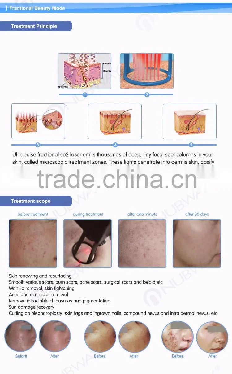 Medical CE Pigment Removal 30W co2 fractional machine with USA Coherent Laser