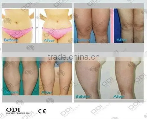 Hot selling !! Unique patented designed fast fit weight loss machine
