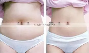 LS08-laura USA popular fat killer liposonix hifu body slimming machine/hifu body shape