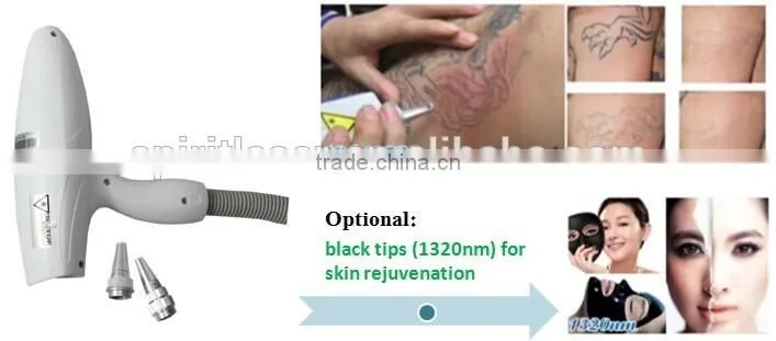 10Hz New Products Q-switch ND YAG Laser Eyebrow Tattoo Removal