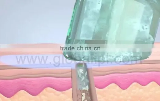 face moisturizing skin whitening portable water oxygen beauty machine
