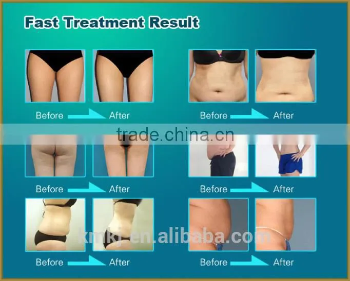 7 different handpieces !!!!! portable ultrasonic slimming cavitation with weight loss,skin tigtening