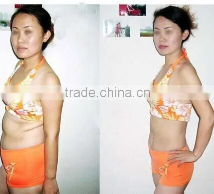 salon use RF Vacuum& cavitation slimming body beauty equipment