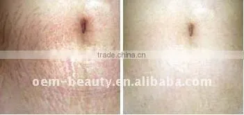 Disk Needle Therapy Derma Roller L005