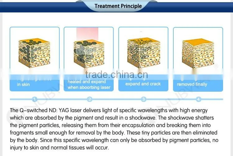 2016 varicose veins laser treatment pigments tattoo removal nd yag laser machine prices
