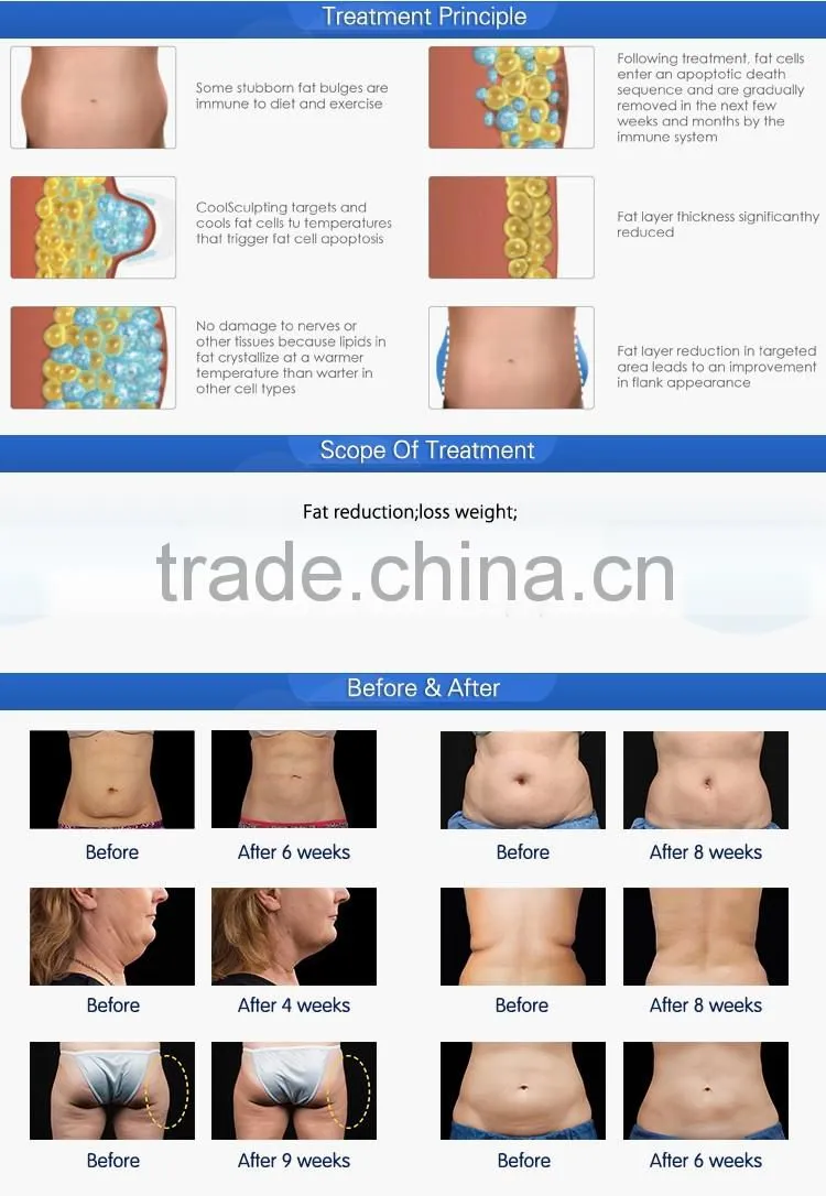 Best & Fastest body slimming machine, fat freezing criolipolisis 2016 weight loss machine