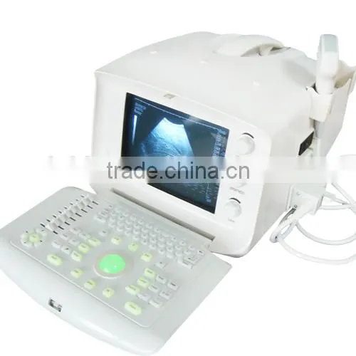 2016 new Digital Portable Ultrasound Scanner good quality low price