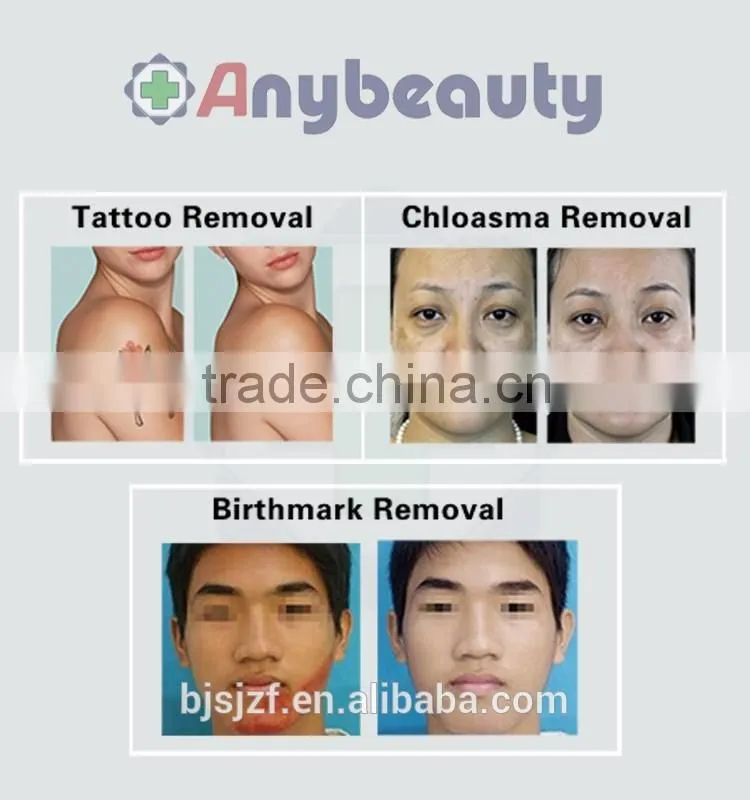 Anybeauty 808nm diode laser hair removal machine for dark skin