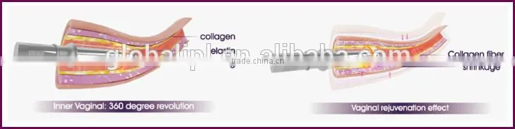 Distinctive treat folliculitis skin tightening smooth surgical scar device