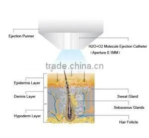 Water Oxygen Injection Acne Treatment Device