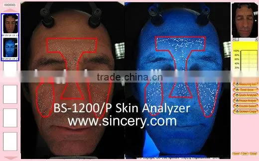 Portable UV Light Facial Skin Analysis Machine Skin Scanner