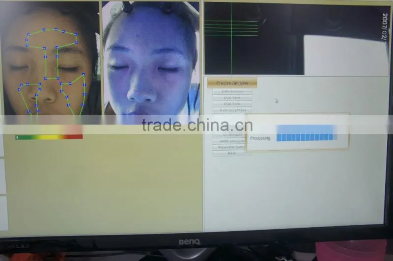 Smart system skin magnifying lamp analyzer skin test facial skin analyzer for clinic use