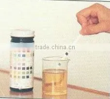 Urine Control Urine Analysis System YH-1520A