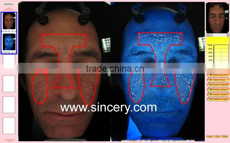 Newest 3D magic mirror visia skin analysis machine