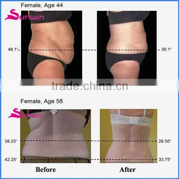 Sunwin SW-29F Forever Top pressotherapy Forever Top pressotherapy machine for cellulite reducing