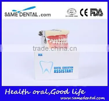 Detachable dentition model for school education dental model
