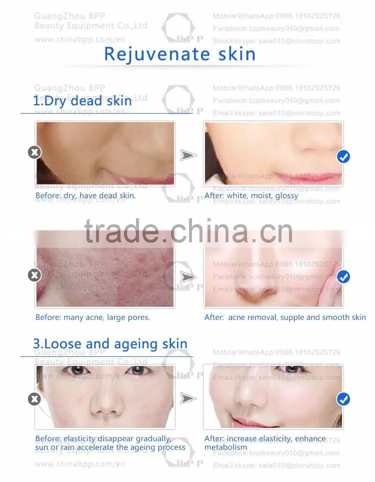 Low price diamond dermabrasion machine