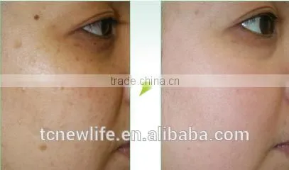 NL-PDT 500 2016 Anti-aging PDT LED facial therapy beauty devices for sale