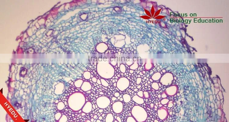 Microscope Prepared Slides ,Stem Slides, Stem of abnormal condition Prepared Slides