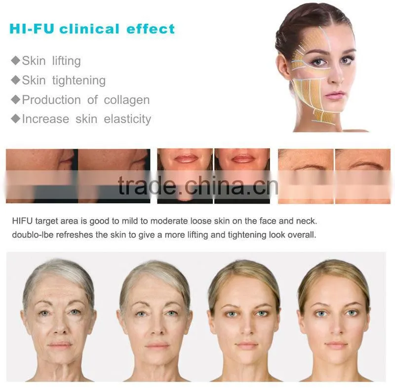 facial pore cleanser machine pore minimizer machine eye bag removal machine