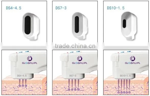 2016 HIFU Vertical hifu ultrasound skin tightening machine for home use