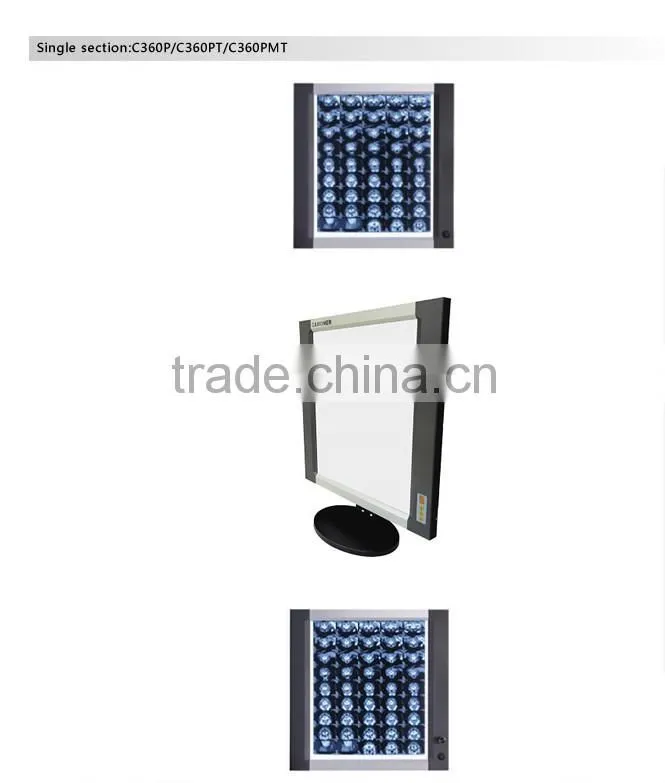 CAMONER LED MEDICAL FILM VIEWER