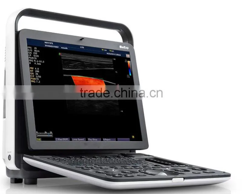 MC-DU-S8EXP Echocardiography Color Doppler Ultrasound Scanner