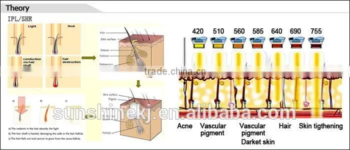 The New Listing hot sale CE approved hair removal equipment shr and ipl