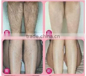 Portable Laser Tattoo Removal Kits