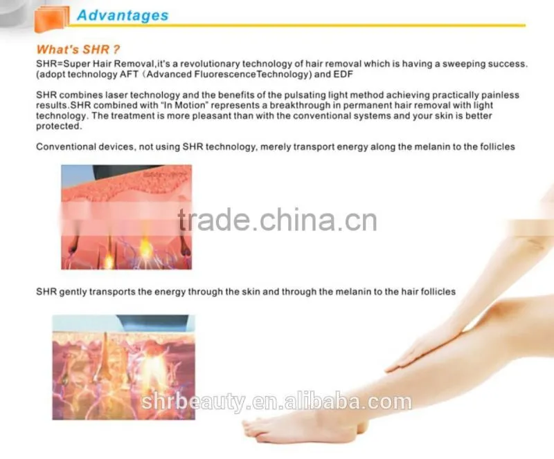 Hot selling Portable SHR IPL Fast Hair Removal 10HZ