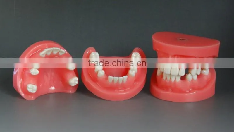 Deletions position plugins dental models DEA-34