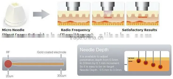 Sanhe PINXEL-2 /Fractional Radiofrequency Microneedle & Matrix Fractional rf
